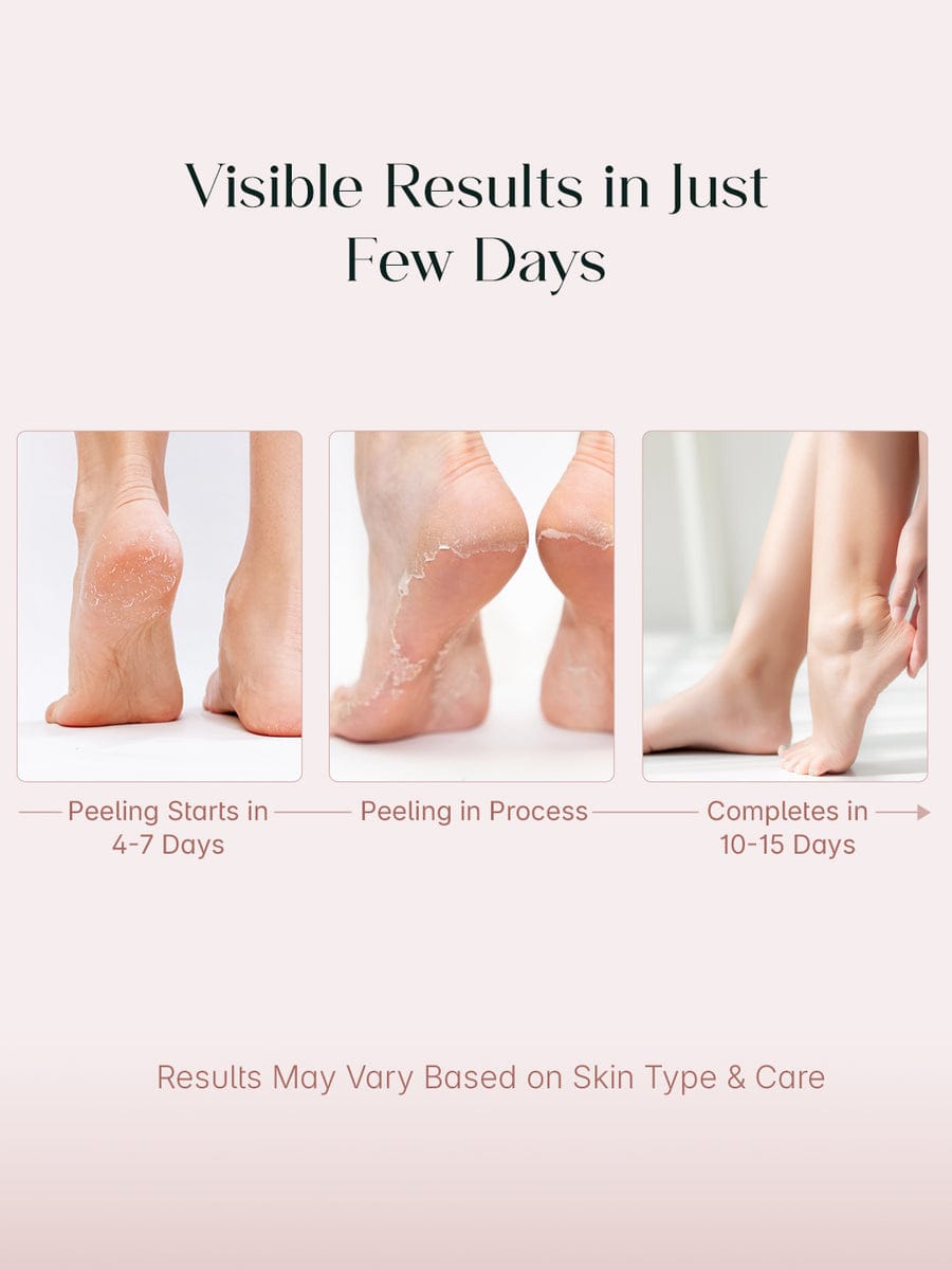 Peeling Foot Mask (One pair)